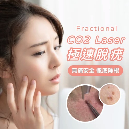 Fractional CO2 Laser 極速脫疣